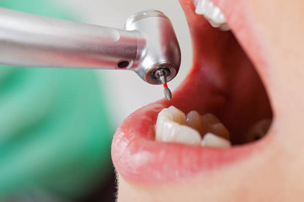 Best Pediatric Emergency Dentist in Lakeside, VA